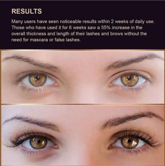 Silksence Eyelash Growth Serum for Lash and Brow Irritation Free Formula (5ML) - Picture 4 of 10